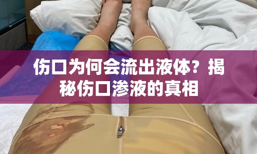 傷口為何會流出液體？揭秘傷口滲液的真相