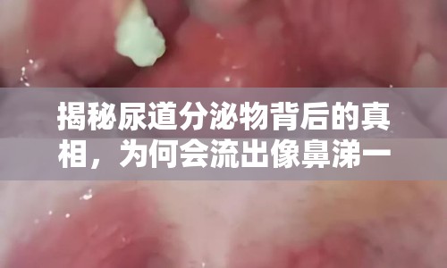 揭秘尿道分泌物背后的真相，為何會流出像鼻涕一樣的東西？