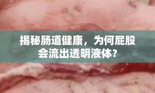 揭秘腸道健康，為何屁股會(huì)流出透明液體？