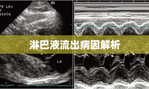 淋巴液流出病因解析