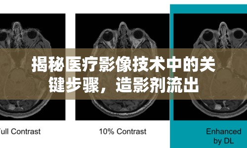 揭秘醫(yī)療影像技術中的關鍵步驟，造影劑流出