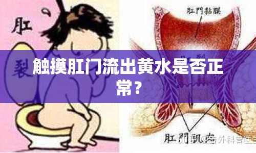 觸摸肛門流出黃水是否正常？