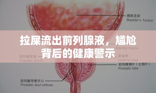 拉屎流出前列腺液，尷尬背后的健康警示