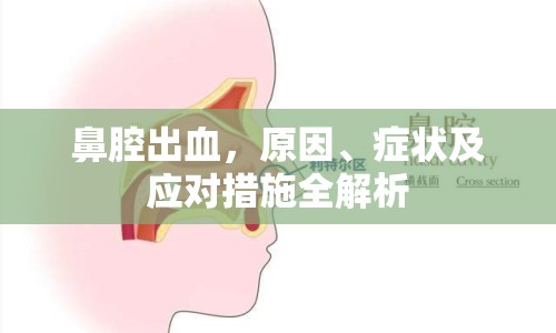 鼻腔出血，原因、癥狀及應(yīng)對措施全解析