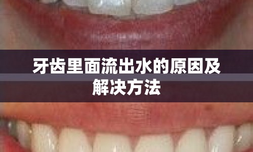 牙齒里面流出水的原因及解決方法