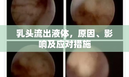 乳頭流出液體，原因、影響及應(yīng)對(duì)措施