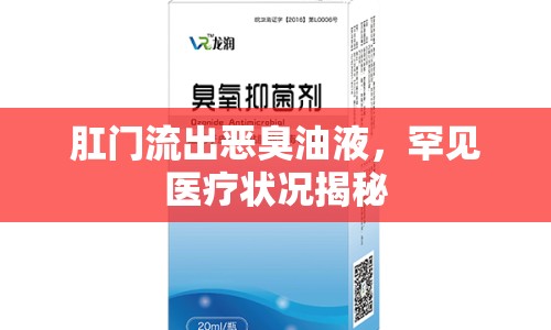 肛門(mén)流出惡臭油液，罕見(jiàn)醫(yī)療狀況揭秘