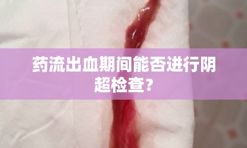 藥流出血期間能否進(jìn)行陰超檢查？