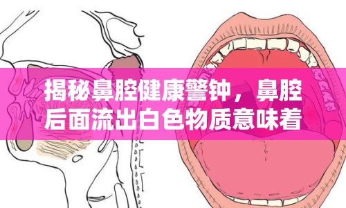 揭秘鼻腔健康警鐘，鼻腔后面流出白色物質(zhì)意味著什么？