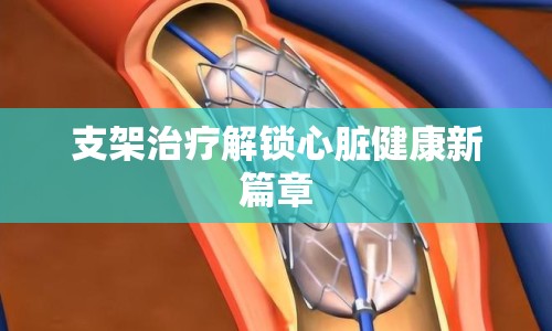 支架治療解鎖心臟健康新篇章