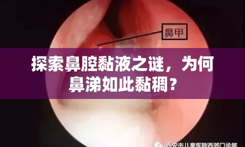 探索鼻腔黏液之謎，為何鼻涕如此黏稠？