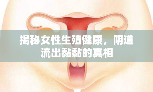 揭秘女性生殖健康，陰道流出黏黏的真相