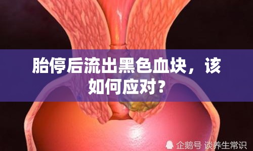 胎停后流出黑色血塊，該如何應(yīng)對？