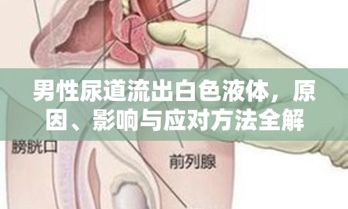 男性尿道流出白色液體，原因、影響與應(yīng)對(duì)方法全解析