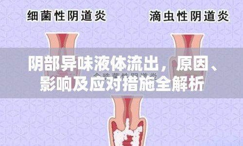 陰部異味液體流出，原因、影響及應(yīng)對(duì)措施全解析