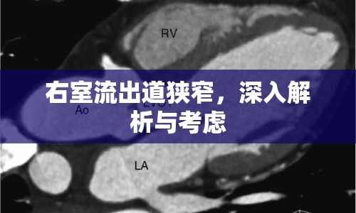 右室流出道狹窄，深入解析與考慮