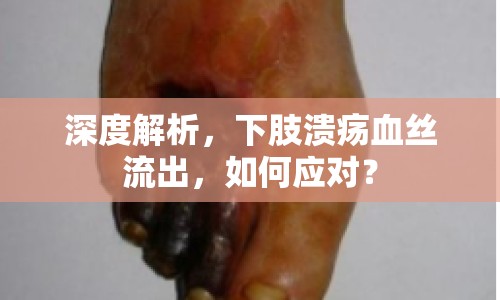 深度解析，下肢潰瘍血絲流出，如何應對？