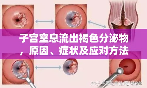 子宮窒息流出褐色分泌物，原因、癥狀及應(yīng)對(duì)方法解析