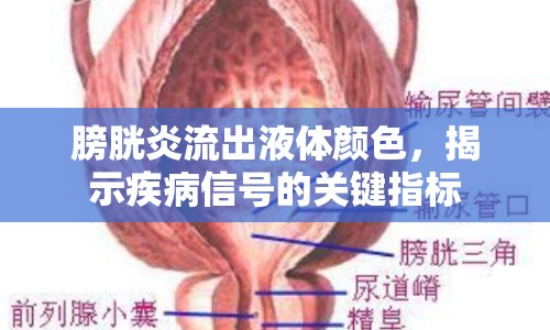 膀胱炎流出液體顏色，揭示疾病信號的關(guān)鍵指標(biāo)