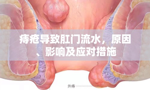 痔瘡導(dǎo)致肛門流水，原因、影響及應(yīng)對措施