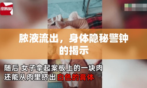 膿液流出，身體隱秘警鐘的揭示