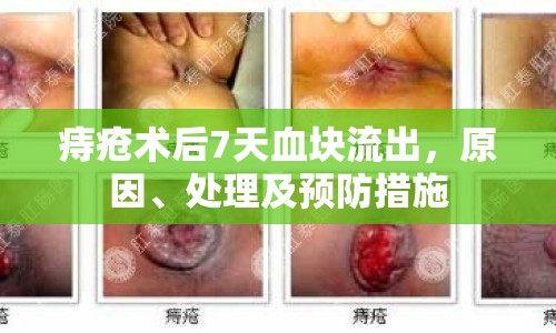 痔瘡術(shù)后7天血塊流出，原因、處理及預防措施