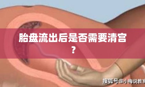 胎盤流出后是否需要清宮？