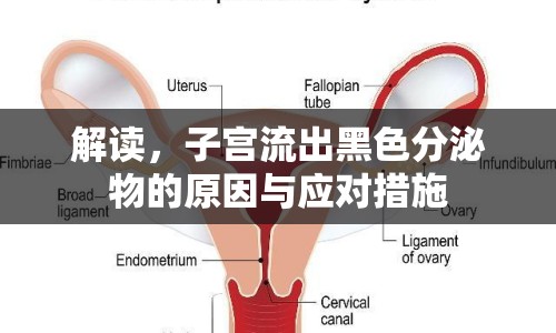 解讀，子宮流出黑色分泌物的原因與應(yīng)對措施