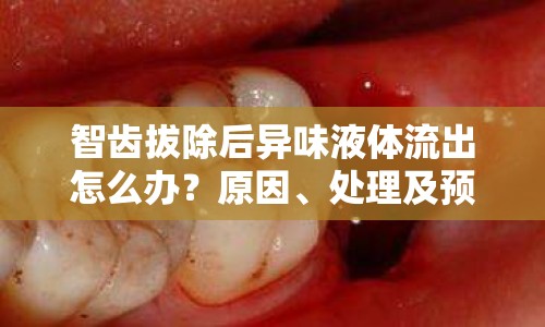 智齒拔除后異味液體流出怎么辦？原因、處理及預防措施全解析