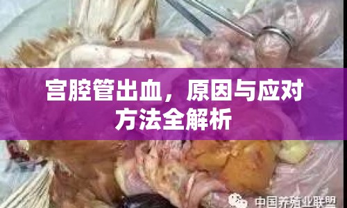 宮腔管出血，原因與應(yīng)對(duì)方法全解析