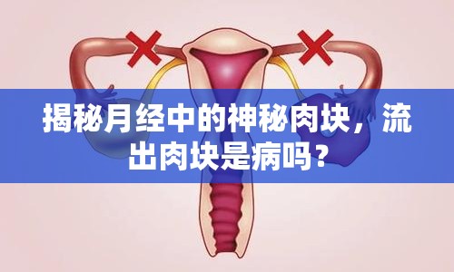 揭秘月經(jīng)中的神秘肉塊，流出肉塊是病嗎？