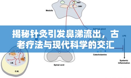 揭秘針灸引發(fā)鼻涕流出，古老療法與現(xiàn)代科學(xué)的交匯