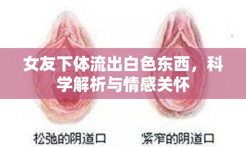 女友下體流出白色東西，科學(xué)解析與情感關(guān)懷