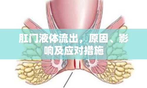 肛門(mén)液體流出，原因、影響及應(yīng)對(duì)措施