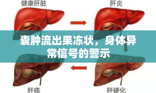 囊腫流出果凍狀，身體異常信號(hào)的警示