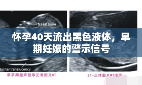 懷孕40天流出黑色液體，早期妊娠的警示信號