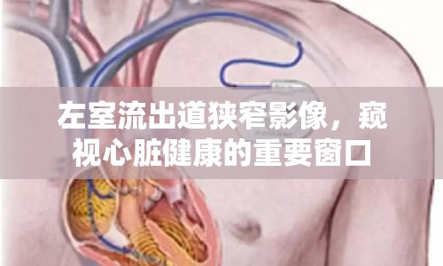 左室流出道狹窄影像，窺視心臟健康的重要窗口