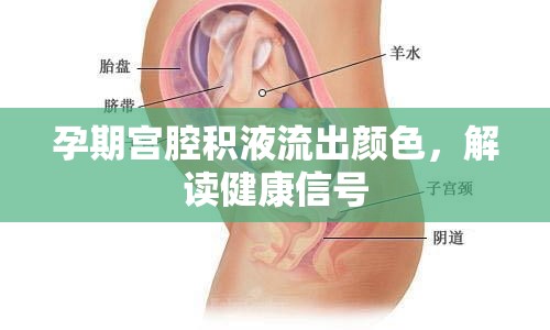 孕期宮腔積液流出顏色，解讀健康信號