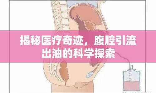 揭秘醫(yī)療奇跡，腹腔引流出油的科學探索