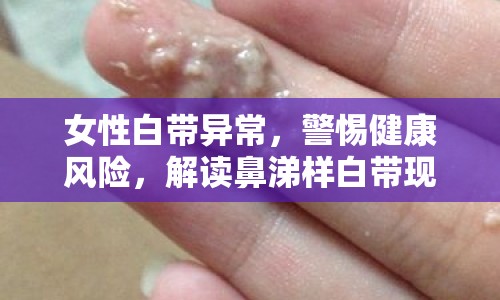 女性白帶異常，警惕健康風(fēng)險，解讀鼻涕樣白帶現(xiàn)象