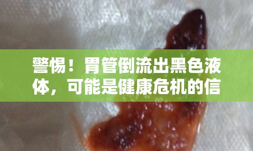 警惕！胃管倒流出黑色液體，可能是健康危機(jī)的信號(hào)