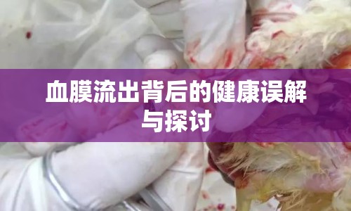 血膜流出背后的健康誤解與探討