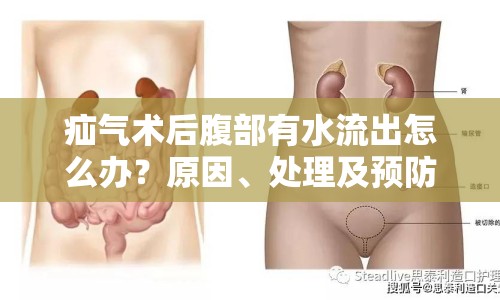 疝氣術(shù)后腹部有水流出怎么辦？原因、處理及預(yù)防措施全解析