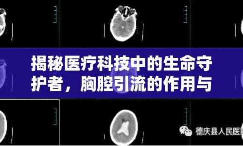 揭秘醫(yī)療科技中的生命守護(hù)者，胸腔引流的作用與重要性