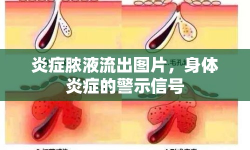 炎癥膿液流出圖片，身體炎癥的警示信號(hào)