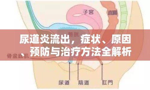 尿道炎流出，癥狀、原因、預防與治療方法全解析