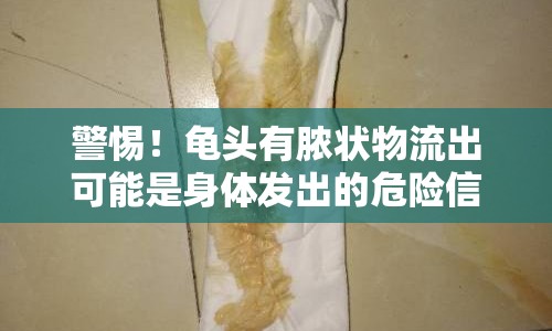 警惕！龜頭有膿狀物流出可能是身體發(fā)出的危險(xiǎn)信號(hào)