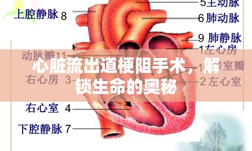 心臟流出道梗阻手術，解鎖生命的奧秘