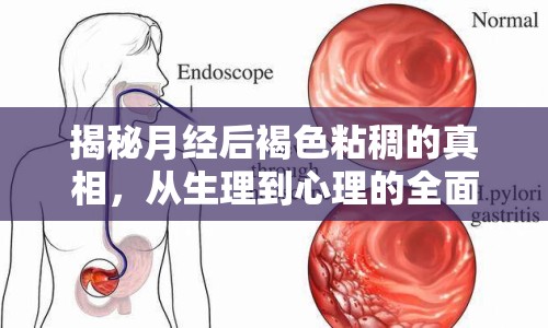 揭秘月經后褐色粘稠的真相，從生理到心理的全面解析