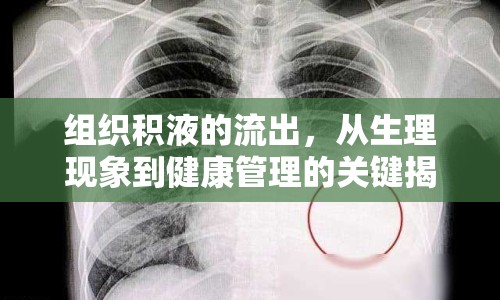 組織積液的流出，從生理現(xiàn)象到健康管理的關(guān)鍵揭秘